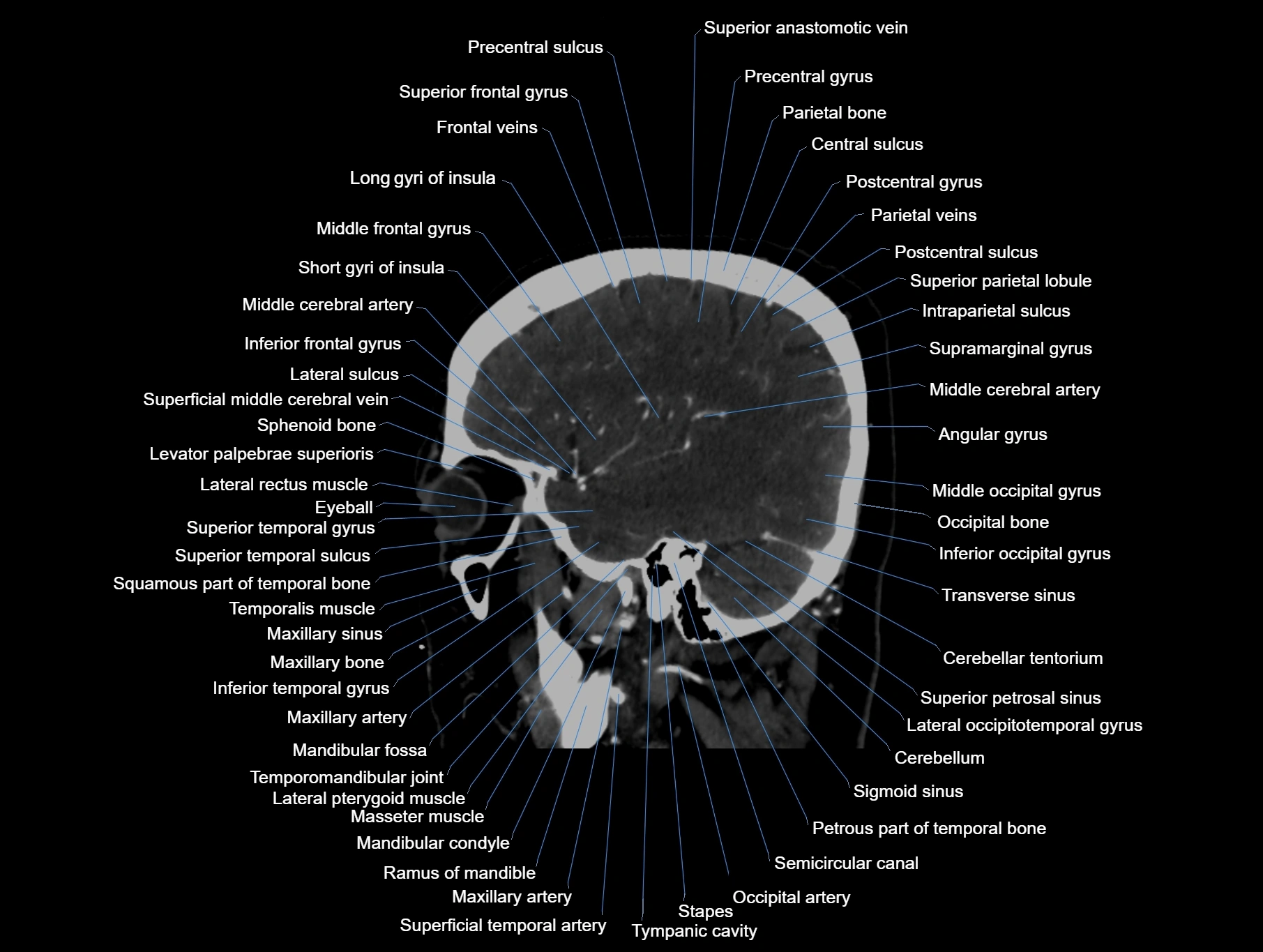 CT scan brain sagittal cross sectional anatomy image-img-00001-00020.webp